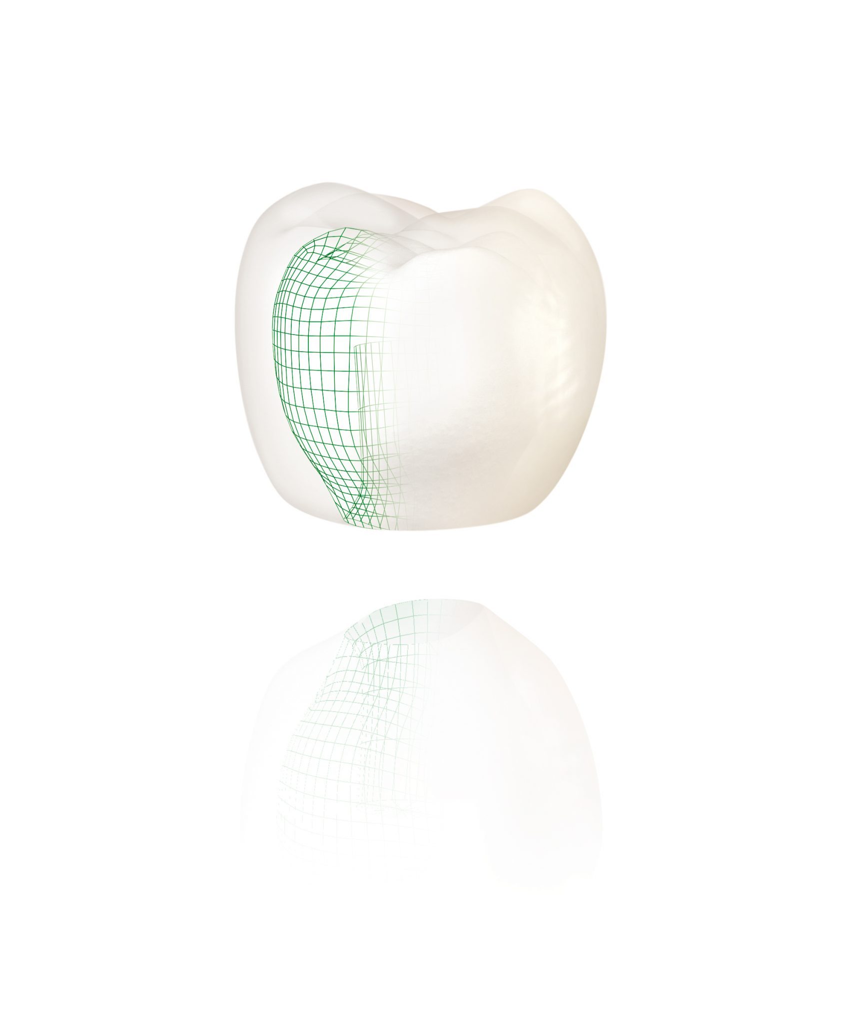 Dental Crowns Preston 