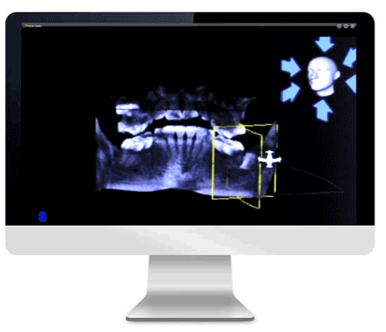 3D Dental Technology for the Best Dental Treatments