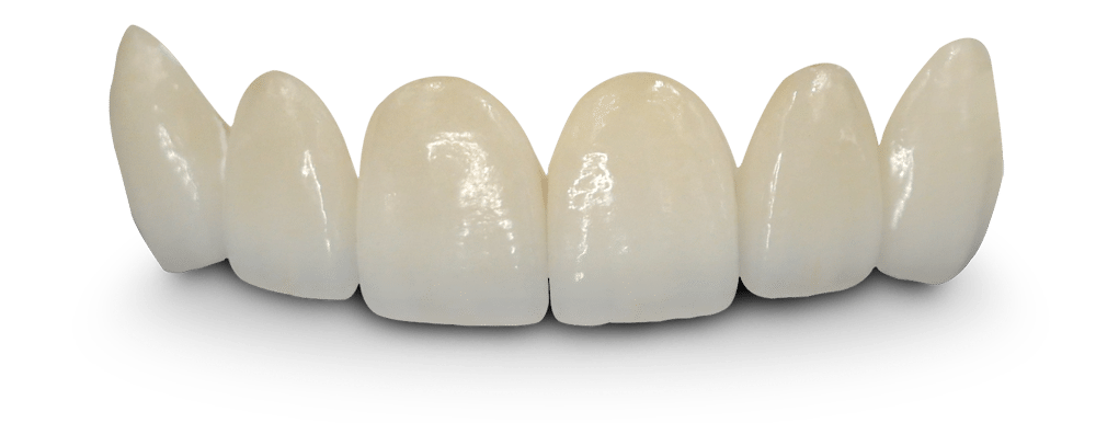 Dental Crowns and Bridges