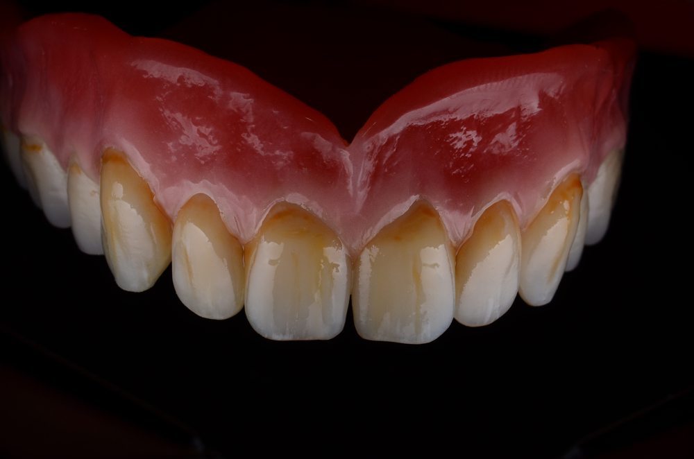 Cosmetic denture prices