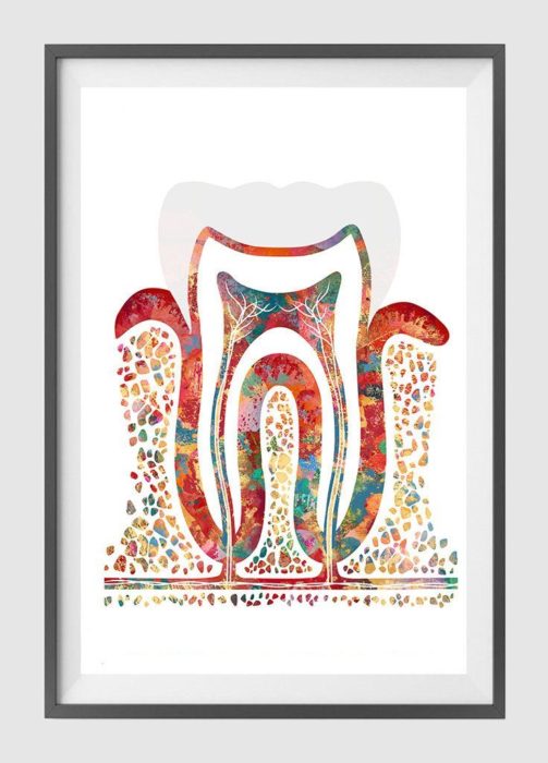 Splinting - Treatment for Loose Teeth