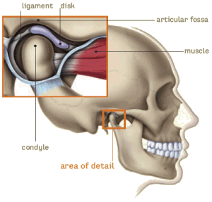 TMJ disorders