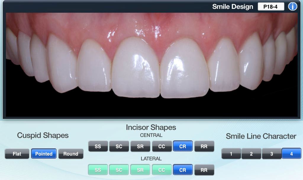 Same Day Smile Makeover 