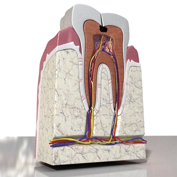 Fractured Tooth