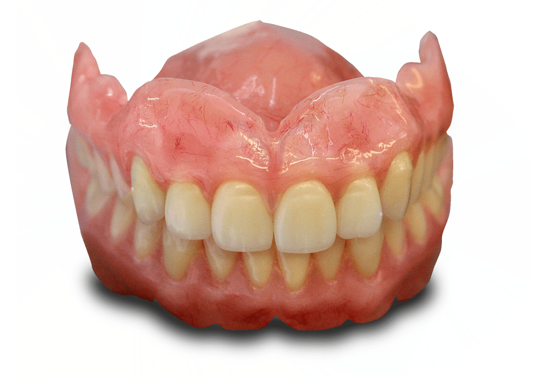 Implant secured Dentures