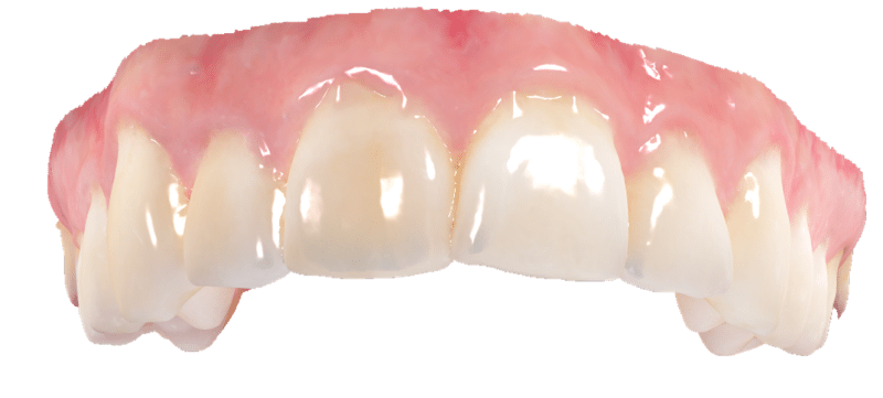 cosmetic dentures
