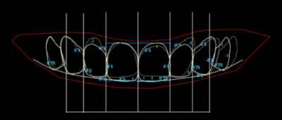 symmetry in smile design