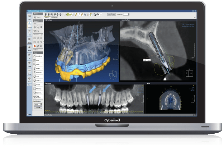 Dental Implants Specialists