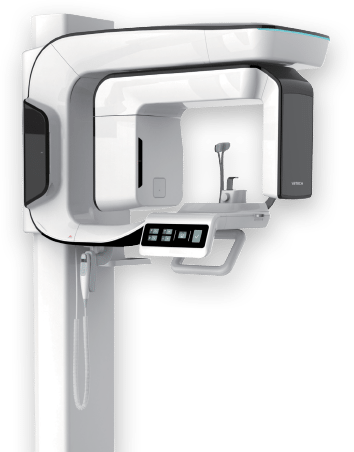 3D Implant Scanner for Denture Implants