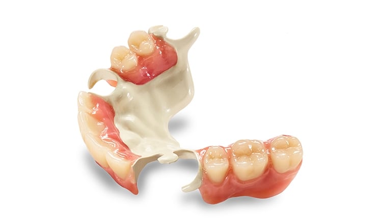 Metal Free Partial Dentures