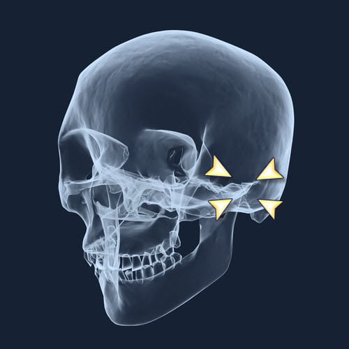 TMD Treatment Options