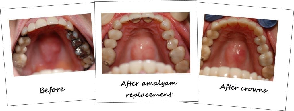 Cosmetic Dentistry Lane Ends Dental Practice Preston