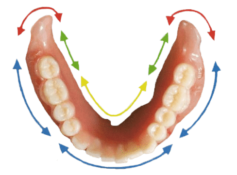 Dentures Treatment