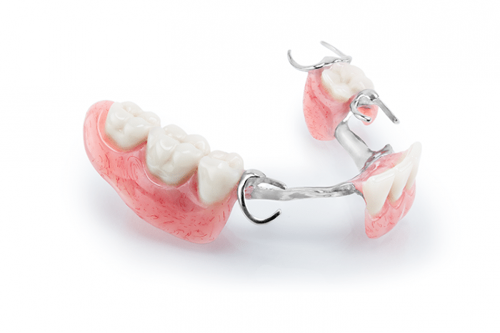 Partial Dentures – Lane Ends Dental Practice – Preston