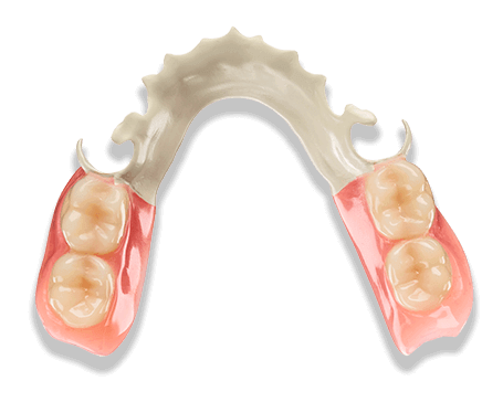 Metal Free Partial Dentures