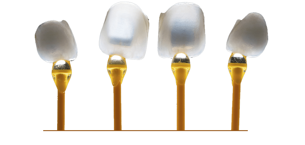 Porcelain Dental Veneers
