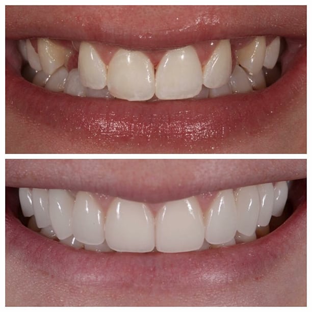 Cosmetic Dentist in Preston Smile MakeOver