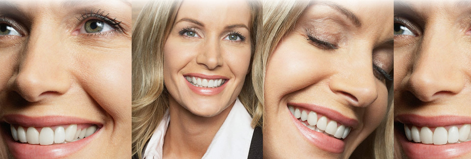 immediate dentures before and after