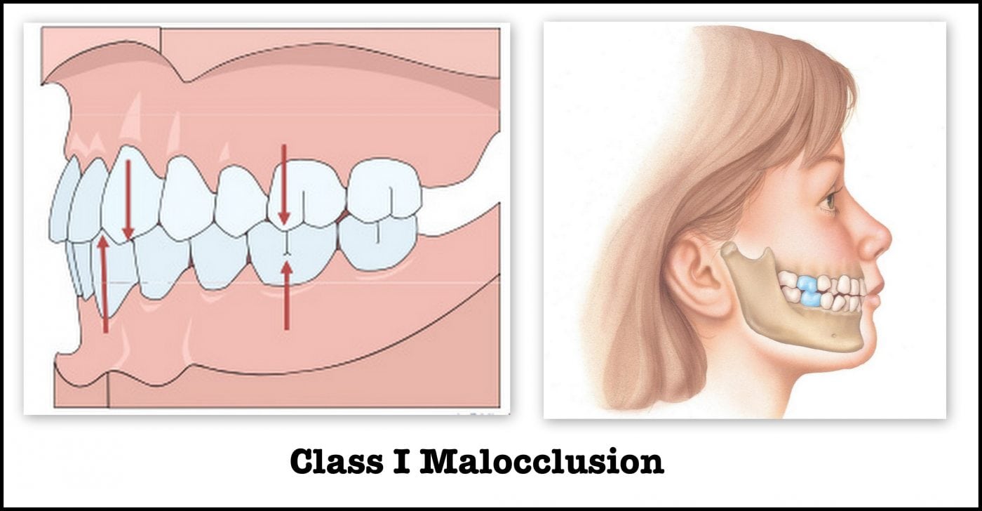 Tmj And Bite Evaluation Cosmetic Dentist In Preston Lancashire 