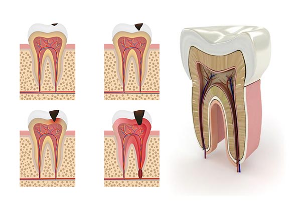 Endodontists in Preston , Lancashire